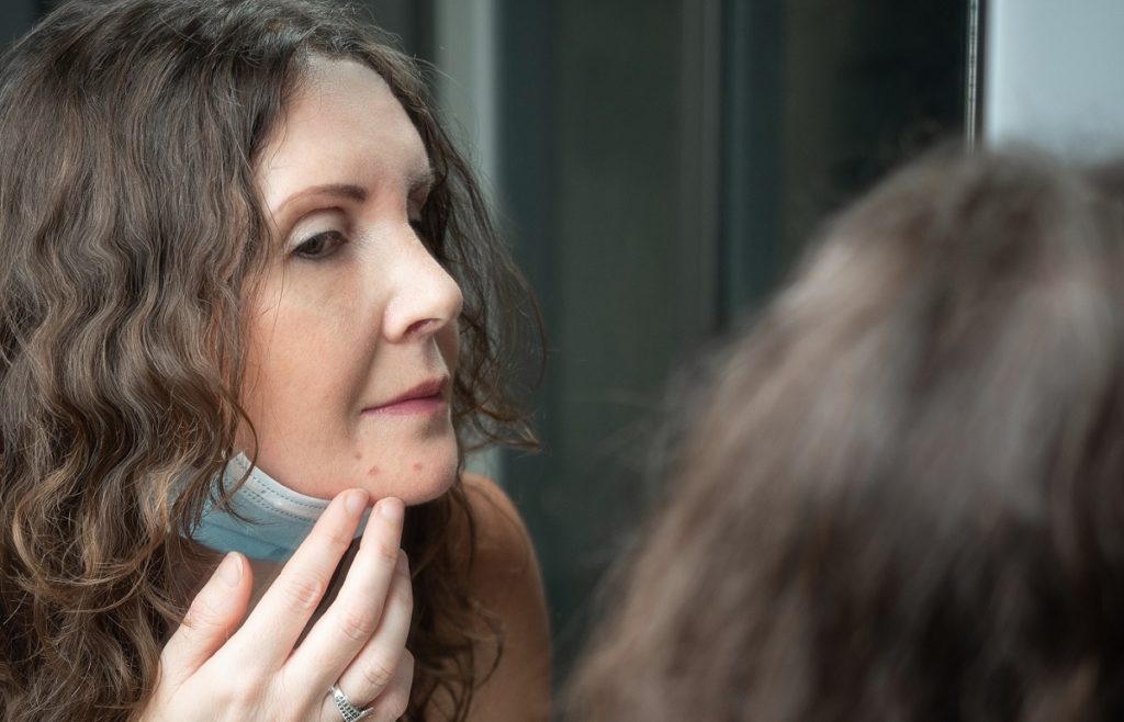 Is your face mask causing breakouts? Urgent Team Family of Urgent